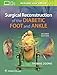 Surgical Reconstruction of the Diabetic Foot and Ankle