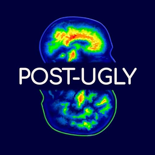 Page de couverture de Binge Drinking, Anxiety & The Brain