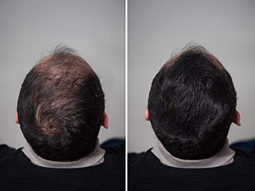 Image of Hair Building Fiber, Hair Liquid Concealer Refill Pack Use For Caboki, Toppik, Looks 21 Etc. Black 50 Gram