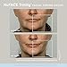 NuFACE Trinity + Effective Lip & Eye Attachment Set , 1 Count (Pack of 1)