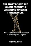 THE STORY BEHIND THE UGLIEST FACE IN THE WRESTLING RING: THE FRENCH ANGEL: How A Medical Disorder Transformed A Normal Boy Into A Legend (English Edition)