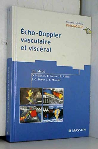 Echo-doppler vasculaire et visceral