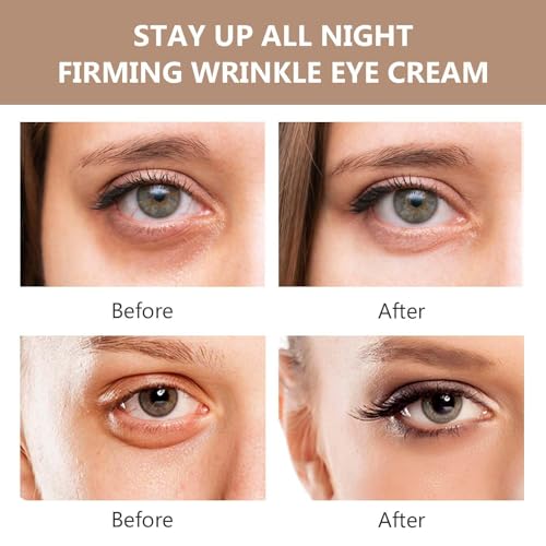 Aohoyaca 2Pcs CelynInstant Firm Eye Tightener, Celyn Eye Bag Cream Ultra Moisturizing, CELYN - Celyn Instant Firm Eye Tightener Eye Bag Cream, Bright and Tight,Firm and Smooth the Look of Fine Lines - Image 6