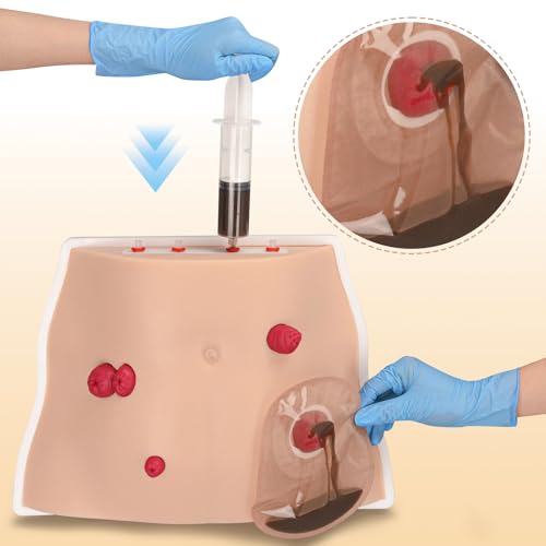 Image of Ostomy Care Trainer Kit, Realistic Abdominal Stoma Model with 4 Stoma Types, Medical Simulation Model for Nursing Students & Patient Care Training