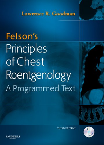 Felson's Principles of Chest Roentgenology: A P... 8131204707 Book Cover