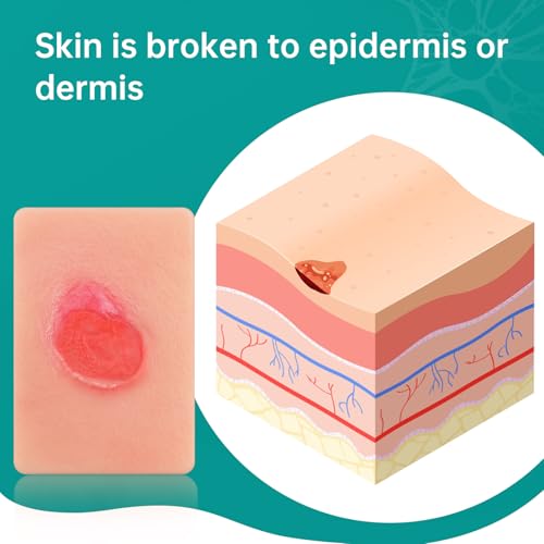 Image of Pressure Ulcer Wound Model Stage 2 Pocket Size, Pressure Injury Wound Packing Trainer for Medical Education, Decubitus Ulcer Wound Care Demonstrations Tool