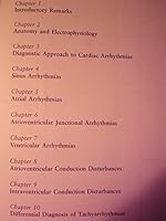 Manual of Cardiac Arrhythmias 0914316443 Book Cover