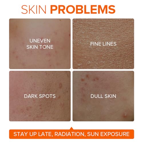 Vitamin C Moisturiser For Face Cream, Anti Aging & Wrinkle Day And Night Face Cream For Women & Men, Brighten & Even Skin Tone, Boost Skin Collagen, Reduce Fine Lines for Skin Care - Image 7