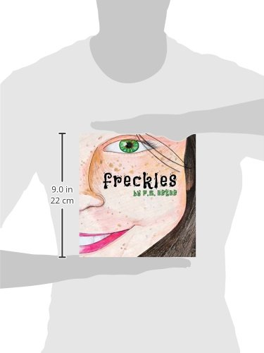 Freckles – vue 2