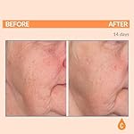 Serious Skincare Vitamin C Serum for Face, Anti-Aging Face Serum with Collagen, Vitamin E, Hydrating Skin Care for Brightening, Improve Appearance of Dark Spots, Tone, Fine Lines & Wrinkles 1 Fl Oz - Image 3