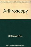 Arthroscopy 0397503717 Book Cover