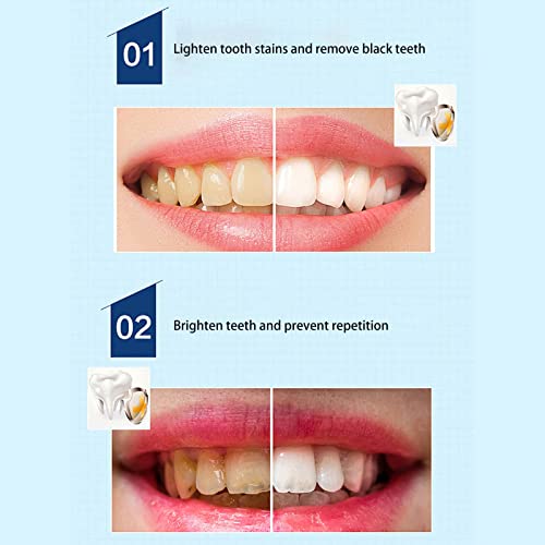 Tandenbleekserum, Vloeistof voor Het Bleken van Tanden, Gele Tanden, Zwarte Tanden, Rokerige Tanden, Reiniging Vlekken op Plaat Verwijderen 30ML Tandverzorging Vloeistof voor Het Bleken van Tanden - Image 4