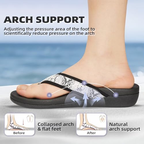 Image of MEGNYA Womens Orthotic Flip Flops, Plantar Fasciitis Sandals for Flat Feet with Arch Support Thong Style Flip Flops, Comfortable Walking Sandals for Beach, Vacation