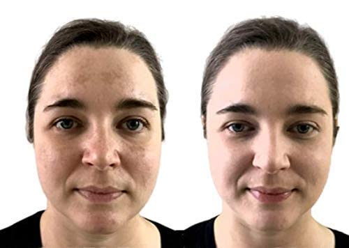 Waterproof Concealer Cream, Full Coverage Waterproof Makeup, Color Match Promise By Dermaflage, 6G/.2Oz #TOP6