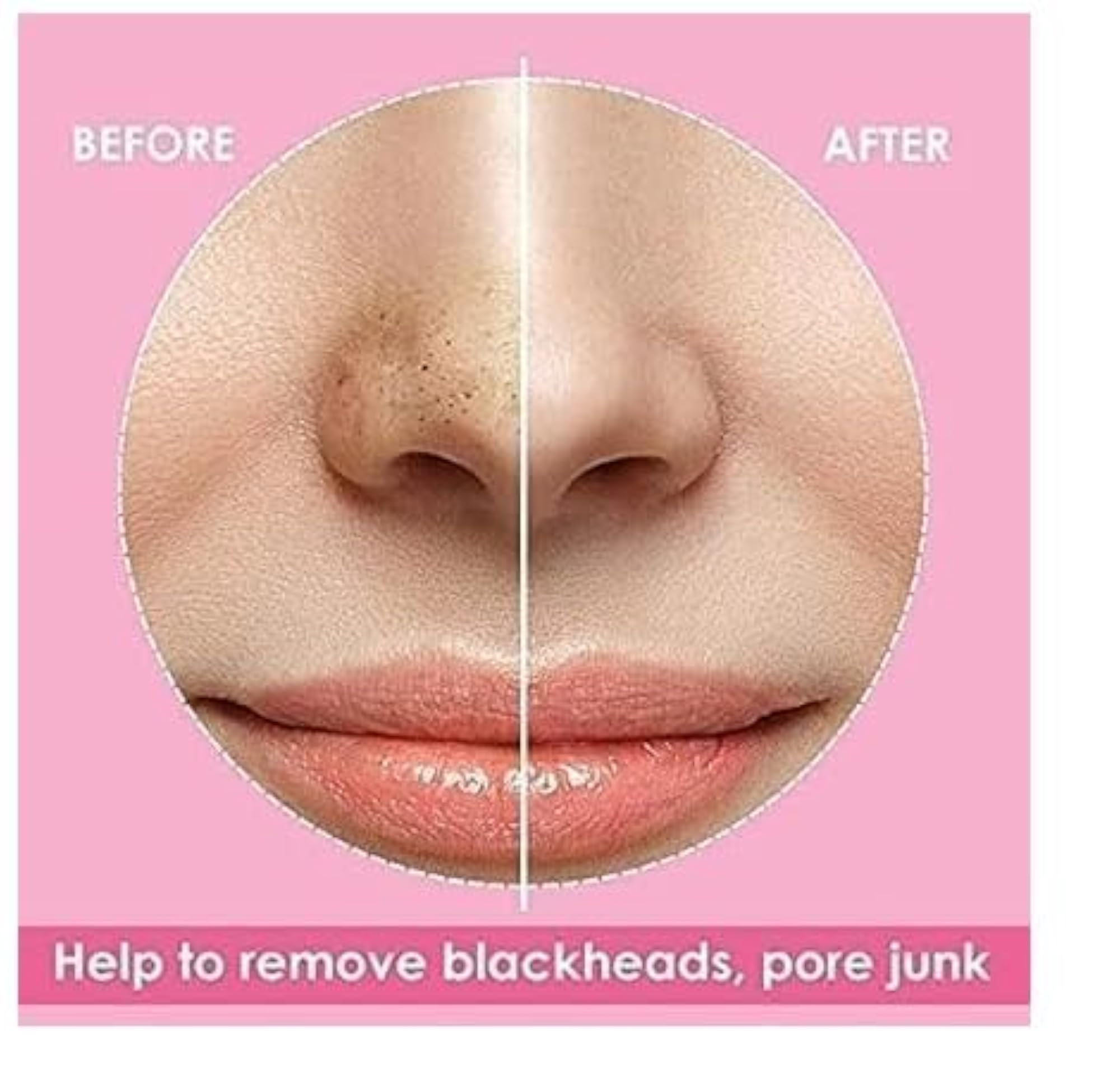 Charcoal Pore Strips for Blackhead Removal, Pack of 6
