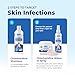 Vetnique Dermabliss Medicated Chlorhexidine Antiseptic Skin Spray for Dogs & Cats, Supports Skin Infections and Irritations 8oz