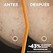 Garnier Sérum Antimanchas con 3,5% Vitamina C, Niacinamida y Ácido Salicílico. En...