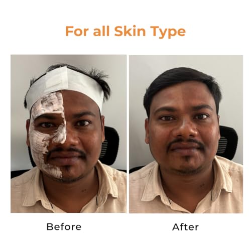 Image of NICONI Gluta-Kojic Skin Polish | D-Tan Professional Face Pack for Brightening & Glow | Instant Tan Removal & Dead Cell Exfoliation | Smooth Radiant Finish | 180g