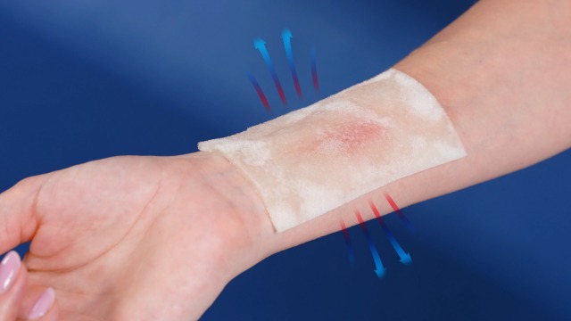 Amazon.com: BurnFix® Burn Gel Pads 4x4 Hydrogel Dressing