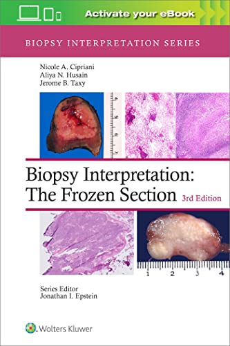 Biopsy Interpretation: The Frozen Section: Print + eBook with Multimedia (Biopsy Interpretation Series)