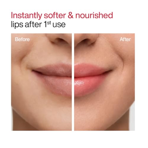 Image of WishCare Lip Balm Combo (Tinted & Untinted) | With Kojic Acid & Niacinamide | Hydrating & Brightening Lip Care | Heals Dry Lips, Reduces Pigmentation & Adds Soft Tint | For Smooth, Even-Toned Lips