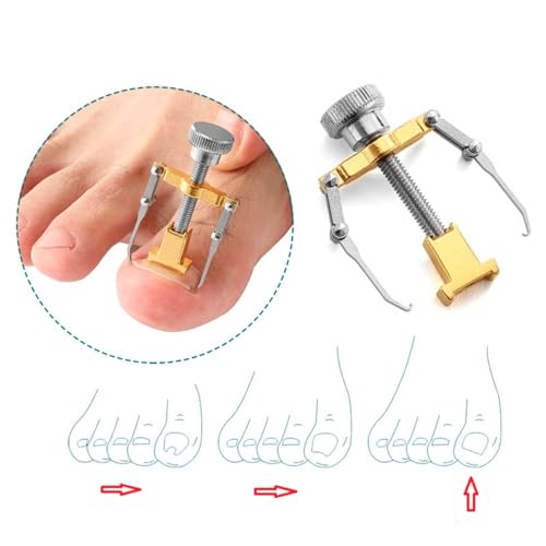 Opiniones y reviews de Desenterrador de uñas Top 5. 14 Imagen adicional