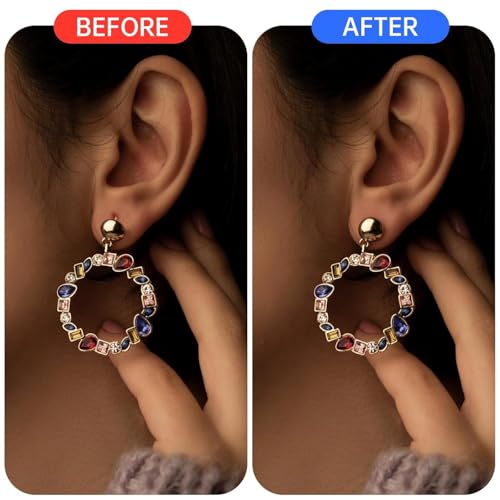 Image of XELYTON Ear Lobe for Support Earrings, Patches Ear lobe Support for Heavy Earring, Invisible Sticker tape, Transparent EarLobe Tapes Ear Lifts Patches (pack of 400)