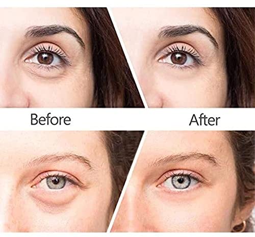 Smaworld 3Pcs Magic Anti-Age Eye Cream, Cayman Eye...