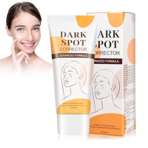 Crema Hidratante Aclarante y Anti Manchas,Crema Eliminadora De Manchas Oscuras Whitening Cream,Hidratante y Rejuvenecedor Facial Crema,Reduce El Melasma,Las Pecas y Las Manchas Solares (yellow, s)