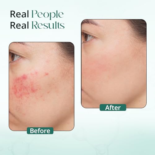 Image of Rice Water Face Wash | Skin Brightening & Oil Control | With Niacinamide & Aloe Vera | Korean Face Wash for Skin Glow | Gentle Cleanser for All Skin Types | 100ml