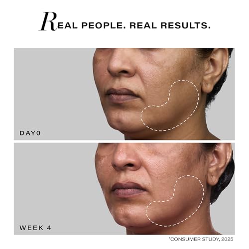 Image of Novology Pro-Lift Cellular Restoration Anti-Ageing Serum with 5.3% Pro Retinol + Adenosine Triphosphate + Peptides| For Firmer Skin, Reduces Fine Lines & Wrinkles| 28 ML