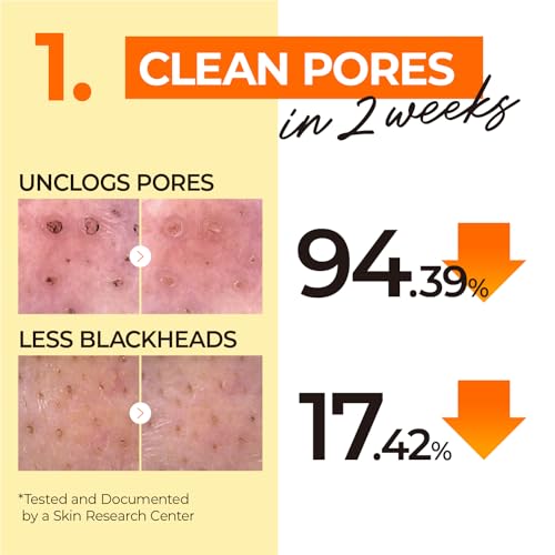 numbuzin Nr.1 Reinigungsöl | Easy Peasy Reinigungsöl | Gesichtsreiniger, Make-up-Entferner, porentiefereiningung, entfernt Mitesser, nicht beschwerend | koreanische Hautpflege | 200 ml