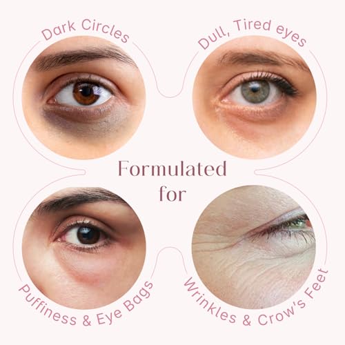 Image of Seoulskin under eye cream | dark circles removal for women and men | Under Eye Gel to Reduce Dark Circles, Puffiness & Wrinkles With Built-in Cooling Massage Roll-On Applicator | 5% Niacinamide, 2% Alpha Arbutin | 15 ml