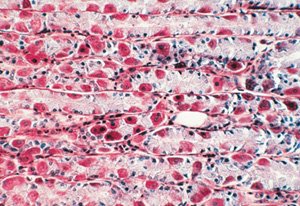 Image of 3B Scientific GmbH W13401 Series II. Metabolism English