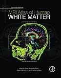 MRI Atlas of Human White Matter