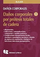 Daños corporales por prótesis totales de cadera 1 9875170941 Book Cover