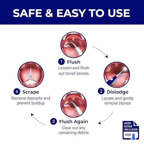 Oravix 7-Piece Tonsil Kit