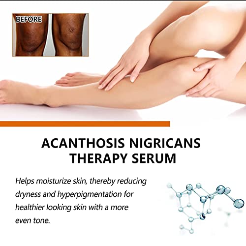 Nicotinamide Liquid Brightening Essential Oil For Face, Whitening Essential Oil Anti-Aging Serum, Anti-Aging Serum With Aloe Vera Extract,Dark Spot Corrector Face Serum (3 Pcs) #TOP4