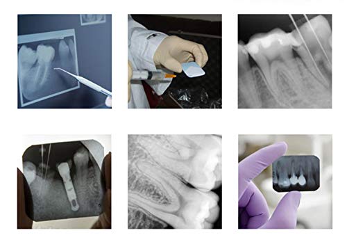 Gltl Dental X-Ray Film Imaging Processor Darkroom Portable Developer For Periapical X Ray Ideal #TOP5