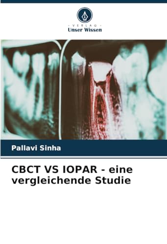 CBCT VS IOPAR - eine vergleichende Studie (German Edition)
