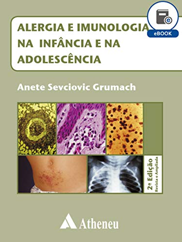 Alergia e Imunologia na Infância e na Adolescência (eBook)