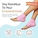 ZenToes Moisturizing Socks for Cracked Heel Treatment, Vitamin E, Olive Oil and Jojoba Oil Infused Heel Socks, Spa Gifts for Women, Mothers Day Gifts (Fuzzy Pink, Regular)