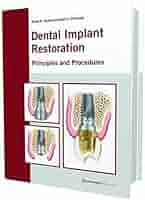 健康・医学 Implant Dentistry: Theory and Practice 41CCRKr97EL._AC_SY200_QL15_.jpg