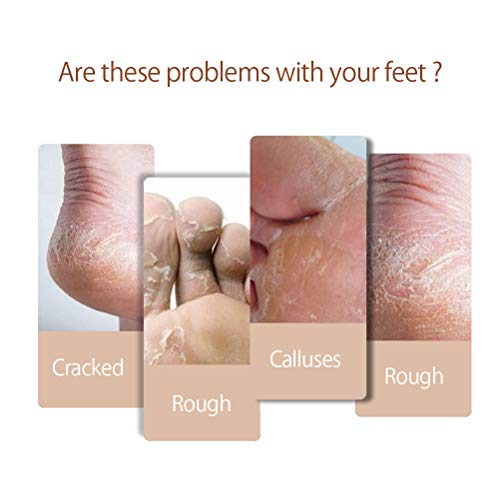 Tumnea Paard olie voetcrème, voetverzorging crème, paardenolie hand-voetcrème anti-schuren van de huid herstelt… - Afbeelding 8