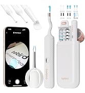 Amazon.co.jp: Bebird 耳かき カメラ付き 【業界初創ピンセット&3.1mm