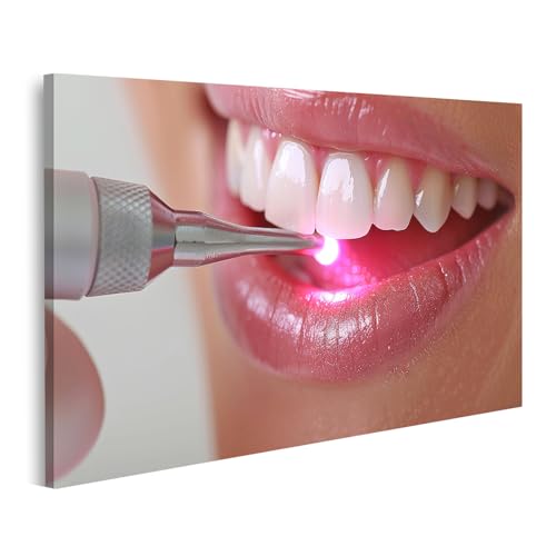 islandburner Bild auf Leinwand Zahnaufhellung mit LED Technologie beim Zahnarzt f&uuml;r Bad Patienten Zahnarztpraxis Bilder Wandbilder Poster