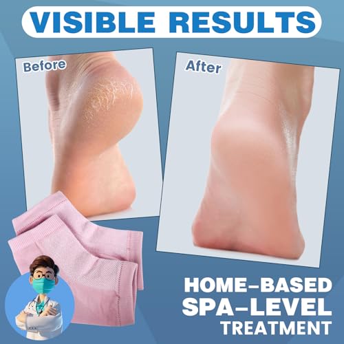 Image of TEAWOO 6 Pairs Pink Moisturizing Heel Socks for Cracked Heel Treatment