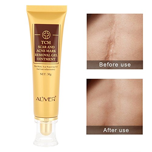Remove Acne Scar Cream,Acne Gel - Remove Acne Scar Cream,Spots Acne Scar Removal,Skin Repair Treatment For Stretch Marks… - Image 6