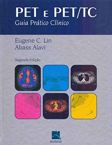 PET e PET/TC: Guia Prático Clínico