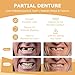 Partial Dentures - Dentures for Missing Teeth & Gaps - Lightweight & Unbreakable Replacement Teeth for Men & Women (2 Teeth)